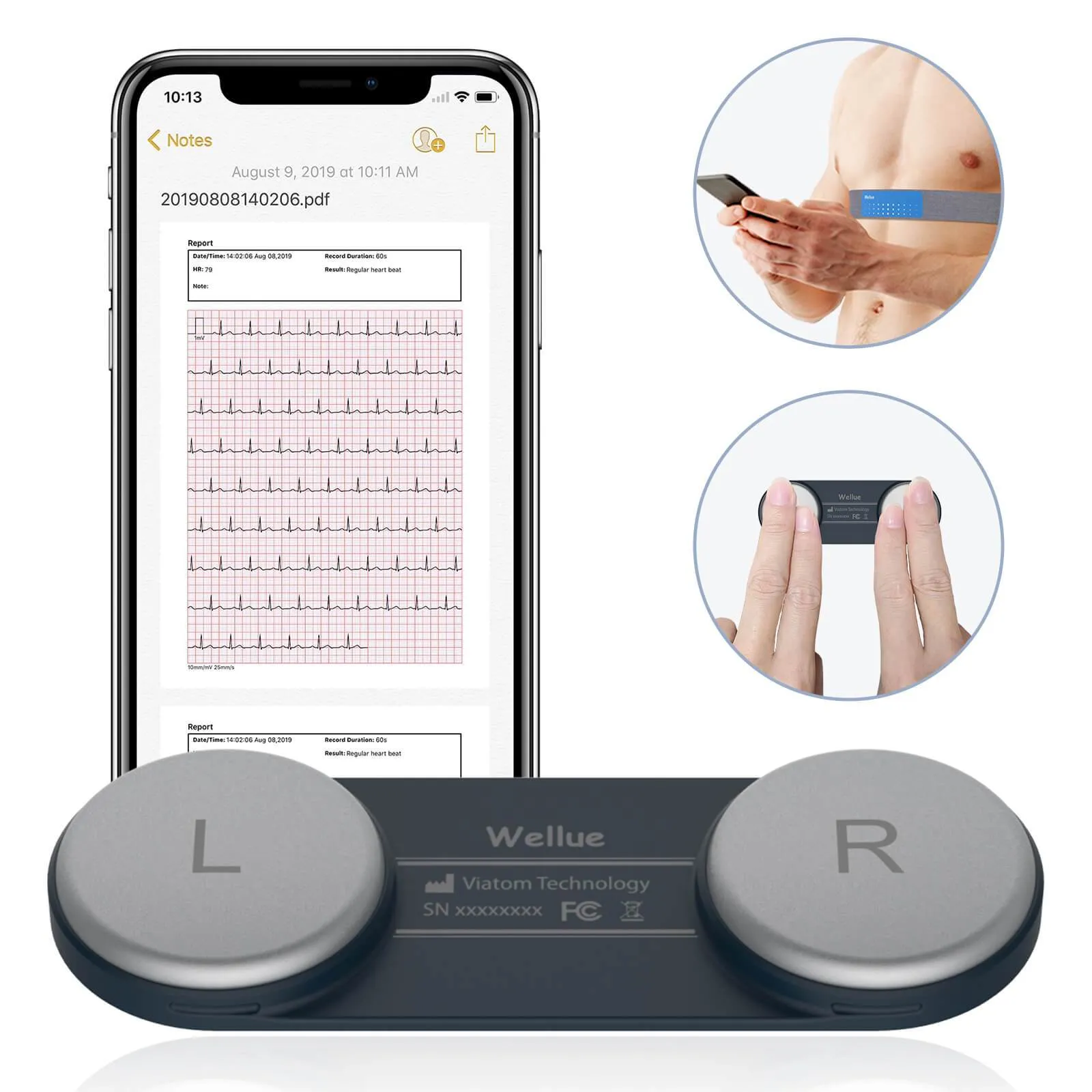 Portable ECG Monitor