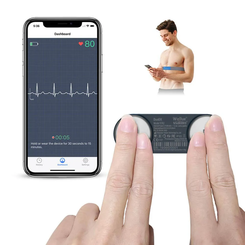 Portable ECG Monitor